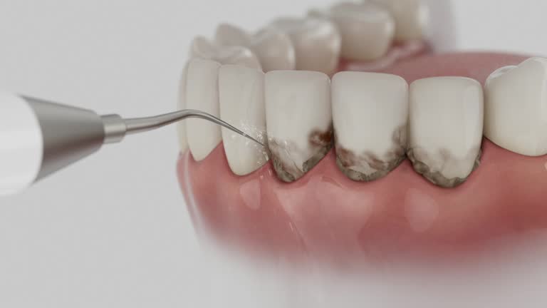 Trusted Teeth Cleaning And Checkup service in Fairview, CA - Dentist Open Now